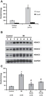 HDAC2 Antibody in Western Blot (WB)