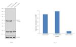 HDAC2 Antibody