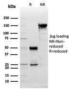 PDGF beta (PDGFB) Antibody in SDS-PAGE (SDS-PAGE)