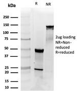 PDGF beta (PDGFB) Antibody in SDS-PAGE (SDS-PAGE)