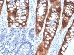 PDGF beta (PDGFB) Antibody in Immunohistochemistry (Paraffin) (IHC (P))