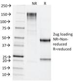 TDP2/EAPII Antibody in SDS-PAGE (SDS-PAGE)