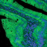 Claudin 2 Antibody in Immunohistochemistry (IHC)