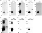 Estrogen Receptor beta Antibody in Western Blot (WB)