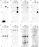 Estrogen Receptor beta Antibody in Western Blot (WB)