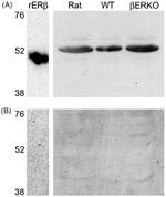 Estrogen Receptor beta Antibody in Western Blot (WB)