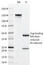 PLGF (Placental Growth Factor) Antibody in SDS-PAGE (SDS-PAGE)