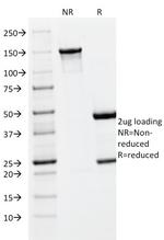 PLGF (Placental Growth Factor) Antibody in SDS-PAGE (SDS-PAGE)