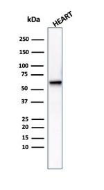 Aciculin/Phosphoglucomutase 5 (PGM5) Antibody in Western Blot (WB)