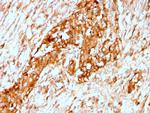 Alpha-1-Antitrypsin (SERPINA1) Antibody in Immunohistochemistry (Paraffin) (IHC (P))