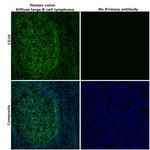 CD20 Antibody in Immunohistochemistry (Paraffin) (IHC (P))