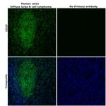 CD20 Antibody in Immunohistochemistry (Paraffin) (IHC (P))