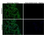 Podoplanin Antibody in Immunohistochemistry (Paraffin) (IHC (P))