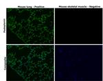 Podoplanin Antibody in Immunohistochemistry (Paraffin) (IHC (P))