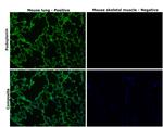 Podoplanin Antibody in Immunohistochemistry (Paraffin) (IHC (P))