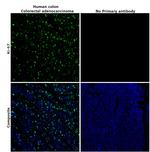 Ki-67 Antibody in Immunohistochemistry (Paraffin) (IHC (P))