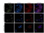 CX3CR1 Antibody in Immunocytochemistry (ICC/IF)