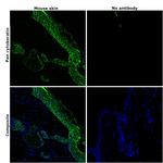 Pan Cytokeratin Antibody in Immunohistochemistry (Paraffin) (IHC (P))