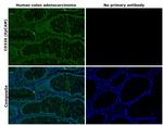 CD326 (EpCAM) Antibody in Immunohistochemistry (Paraffin) (IHC (P))