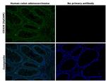 CD326 (EpCAM) Antibody in Immunohistochemistry (Paraffin) (IHC (P))