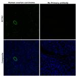 Alpha-Smooth Muscle Actin Antibody in Immunohistochemistry (Paraffin) (IHC (P))