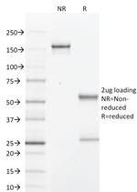 GCDFP-15 Antibody in SDS-PAGE (SDS-PAGE)