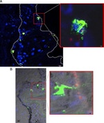 CD207 (Langerin) Antibody in Immunohistochemistry (IHC)