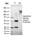 BCL11A/CTIP1 (Transcription Factor) Antibody in SDS-PAGE (SDS-PAGE)