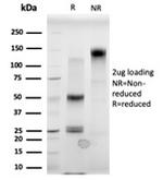 MBD3 Antibody in SDS-PAGE (SDS-PAGE)