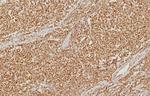 PMS2 (Postmeiotic Segregation Increased 2) Antibody in Immunohistochemistry (Paraffin) (IHC (P))