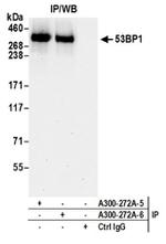 53BP1 Antibody in Western Blot (WB)