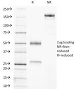 TRAcP (Tartrate-Resistant Acid Phosphatase) Antibody in SDS-PAGE (SDS-PAGE)