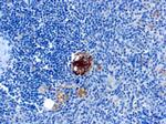 TRAcP (Tartrate-Resistant Acid Phosphatase) (Hairy Cell Leukemia Marker) Antibody in Immunohistochemistry (Paraffin) (IHC (P))