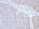 POLE3/CHRAC17 Antibody in Immunohistochemistry (Paraffin) (IHC (P))