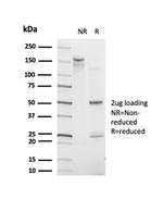 POLE3/CHRAC17 Antibody in SDS-PAGE (SDS-PAGE)