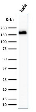 Podocalyxin (PODXL) (Hematopoietic Stem Cell Marker) Antibody in Western Blot (WB)