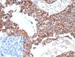 TREM2 (Triggering Receptor Expressed On Myeloid Cells 2) Antibody in Immunohistochemistry (Paraffin) (IHC (P))