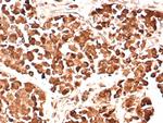 ACTH (Adrenocorticotrophic Hormone) (Pituitary Marker) Antibody in Immunohistochemistry (Paraffin) (IHC (P))