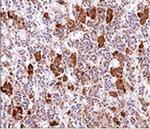 ACTH (Adrenocorticotrophic Hormone) (Pituitary Marker) Antibody in Immunohistochemistry (Paraffin) (IHC (P))