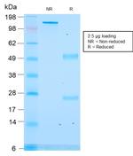 ACTH (Adrenocorticotrophic Hormone) Antibody in SDS-PAGE (SDS-PAGE)