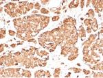 ACTH (Adrenocorticotrophic Hormone) (Pituitary Marker) Antibody in Immunohistochemistry (Paraffin) (IHC (P))