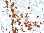 ACTH (Adrenocorticotrophic Hormone) (Adrenal Marker) Antibody in Immunohistochemistry (Paraffin) (IHC (P))