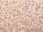 ACTH (Adrenocorticotrophic Hormone) (Pituitary Marker) Antibody in Immunohistochemistry (Paraffin) (IHC (P))