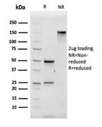 ACTH (Adrenocorticotrophic Hormone) (Pituitary Marker) Antibody in SDS-PAGE (SDS-PAGE)