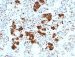 ACTH (Adrenocorticotrophic Hormone) (Pituitary Marker) Antibody in Immunohistochemistry (Paraffin) (IHC (P))