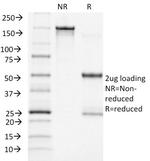 ACTH (Adrenocorticotrophic Hormone) Antibody in SDS-PAGE (SDS-PAGE)