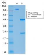 ACTH (Adrenocorticotrophic Hormone) (Pituitary Marker) Antibody in SDS-PAGE (SDS-PAGE)