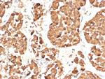 ACTH (Adrenocorticotrophic Hormone) (N-Terminal) (Pituitary Marker) Antibody in Immunohistochemistry (Paraffin) (IHC (P))