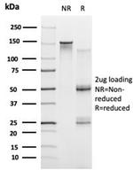 PRMT7 Antibody in SDS-PAGE (SDS-PAGE)