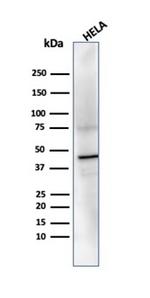 PRMT7 Antibody in Western Blot (WB)